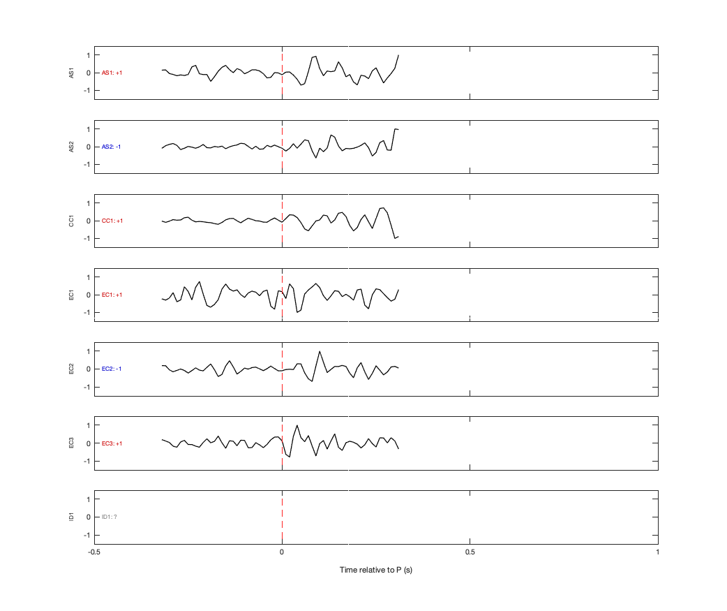 Waveforms