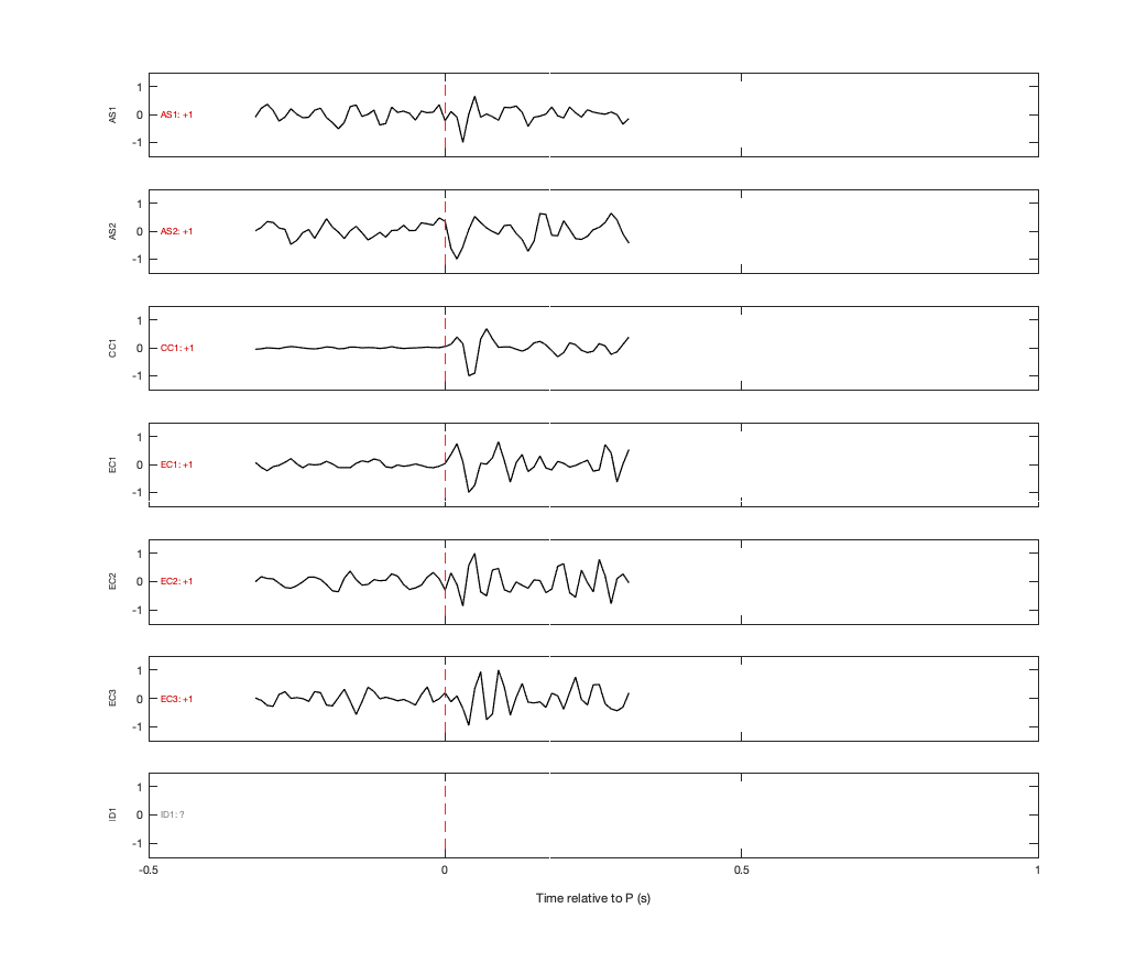 Waveforms