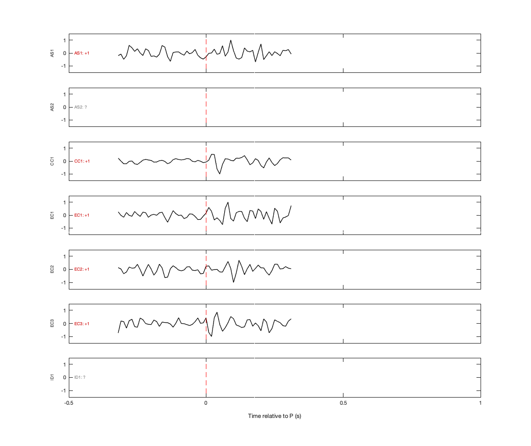 Waveforms