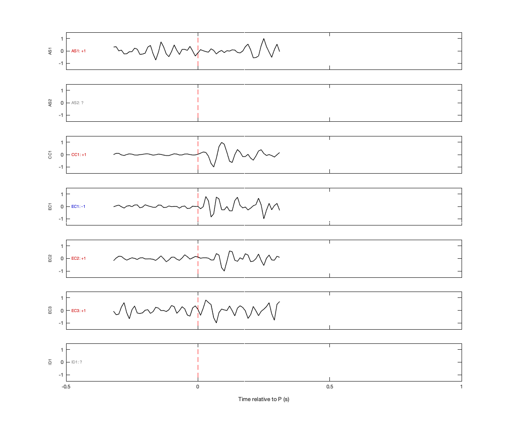Waveforms