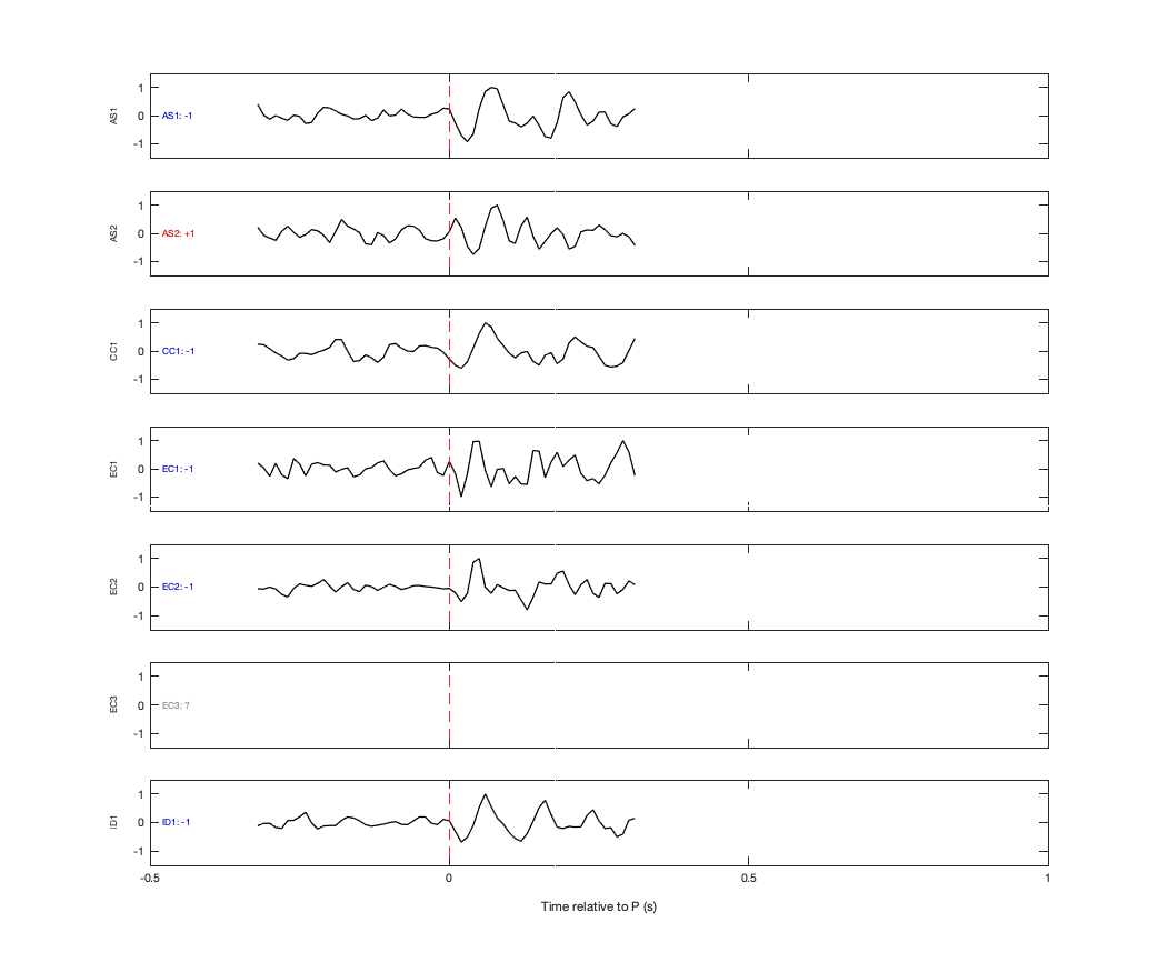Waveforms