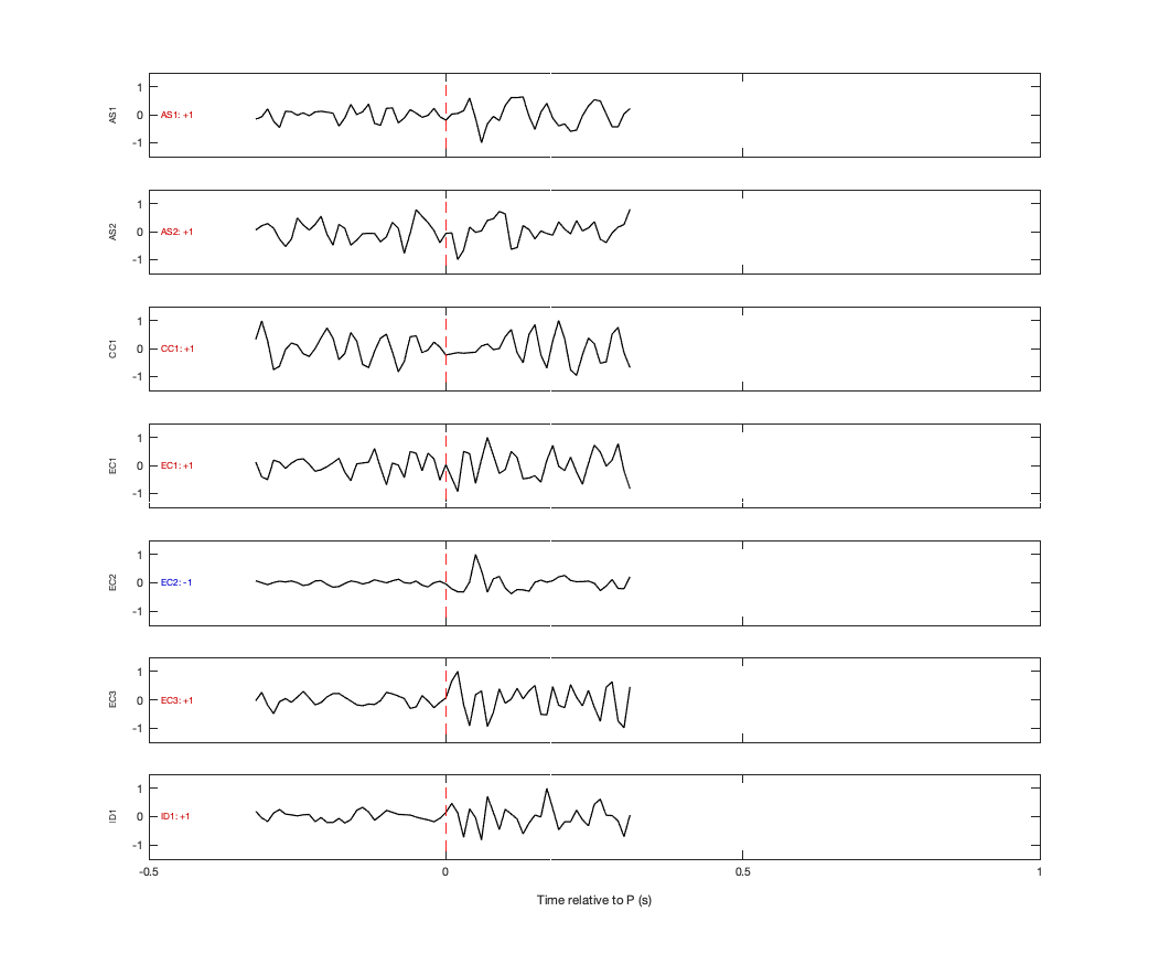 Waveforms
