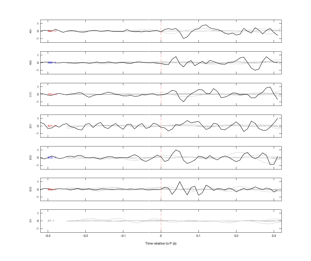 Waveforms