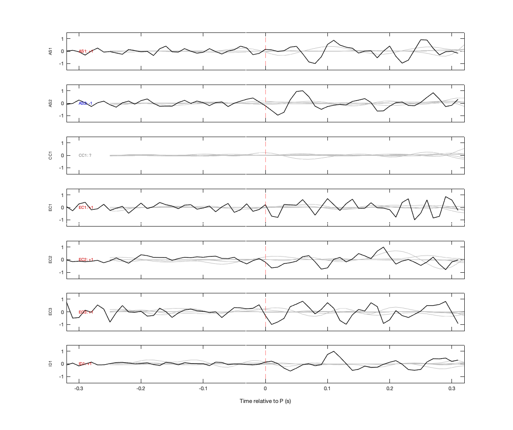 Waveforms