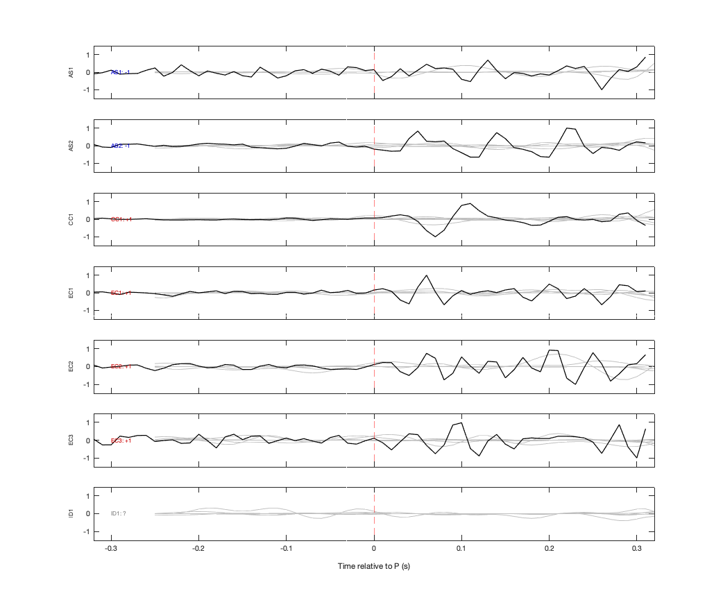 Waveforms