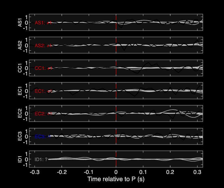 Waveforms