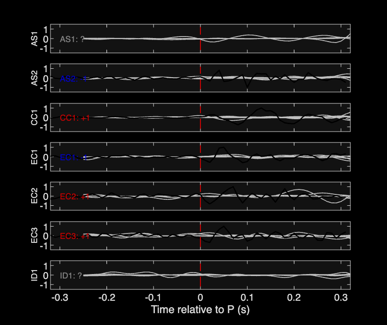 Waveforms