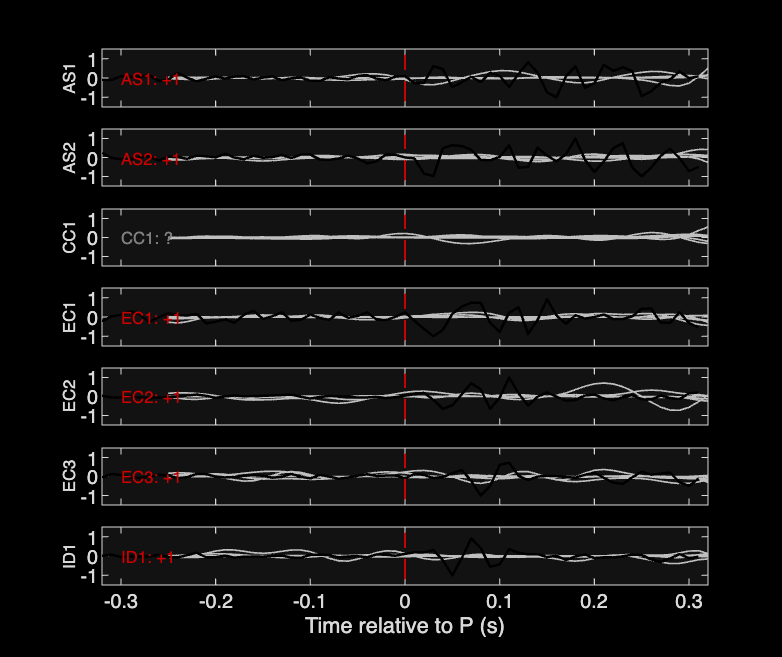 Waveforms