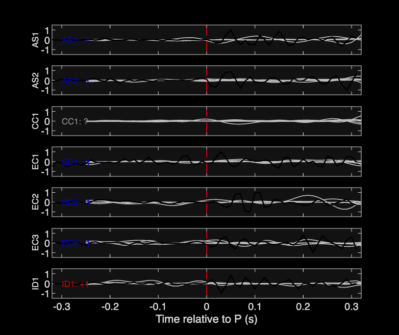 Waveforms