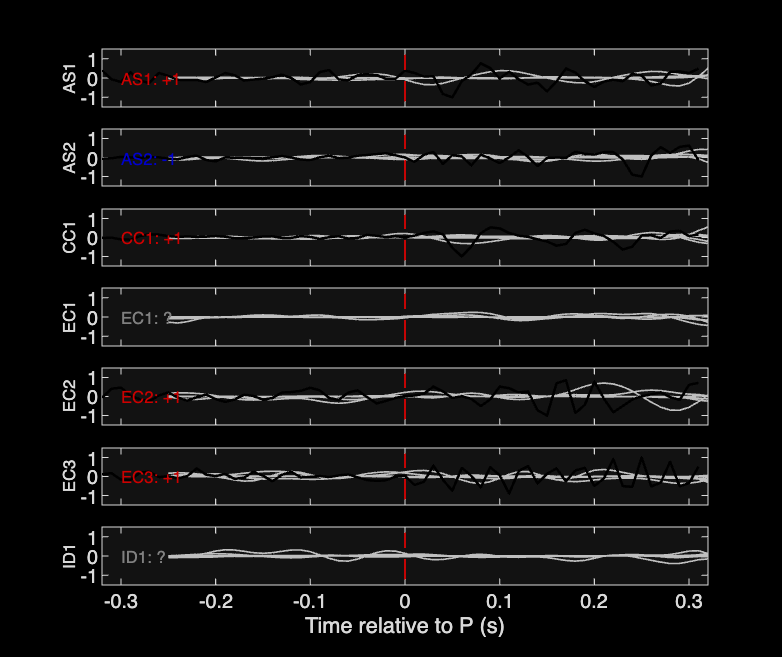 Waveforms