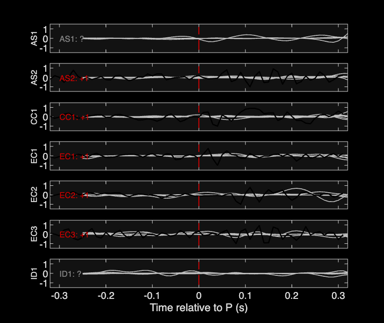 Waveforms