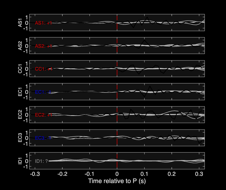 Waveforms