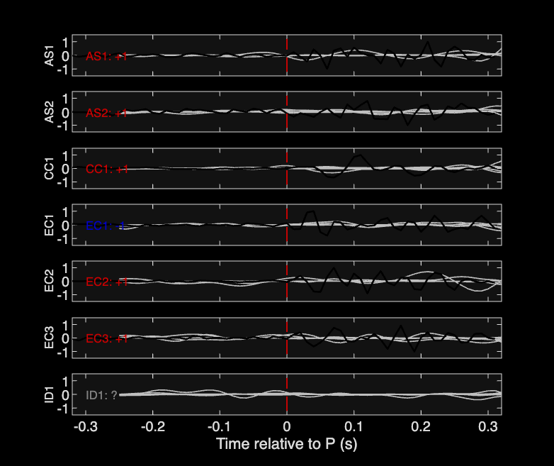 Waveforms