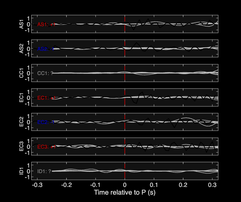 Waveforms