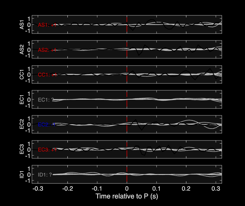 Waveforms