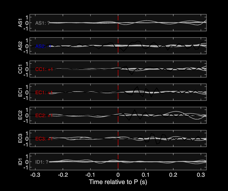 Waveforms