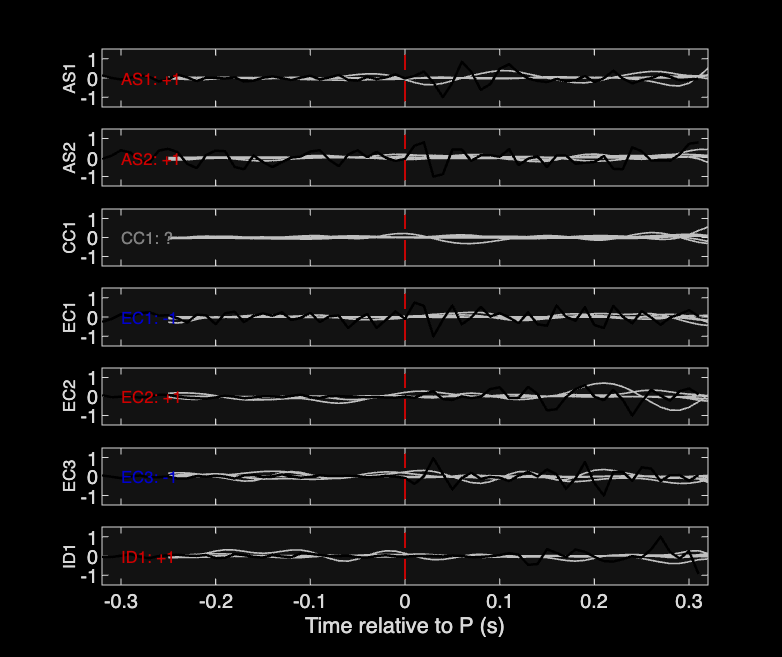Waveforms