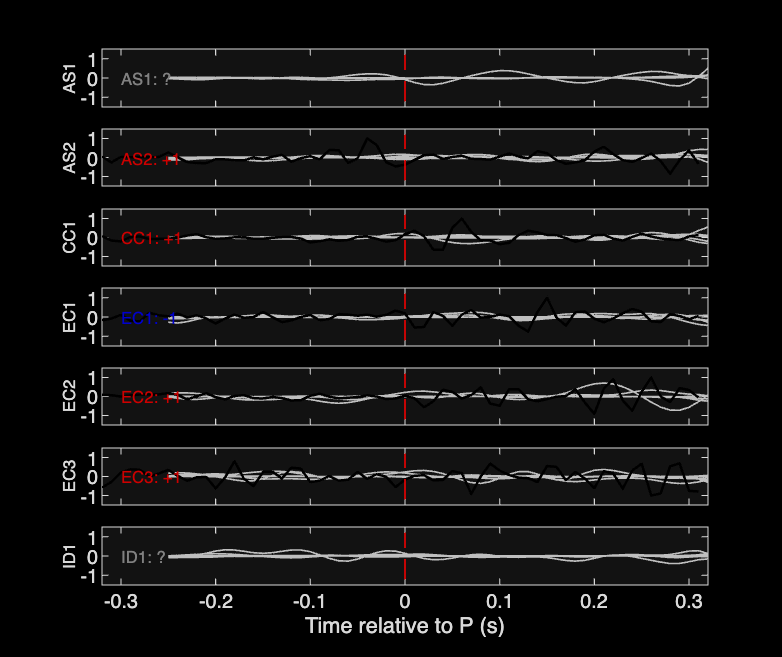 Waveforms