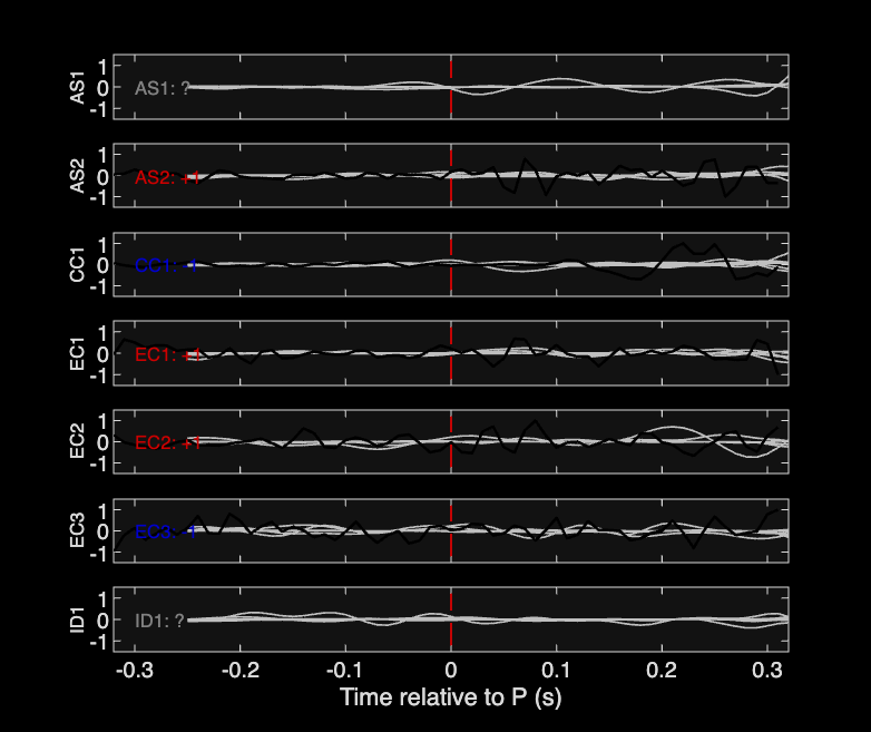 Waveforms