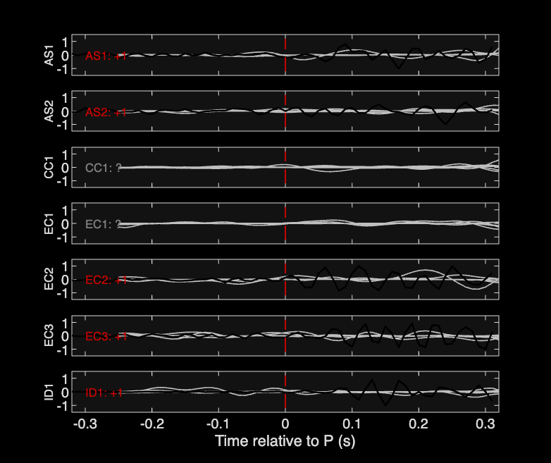 Waveforms