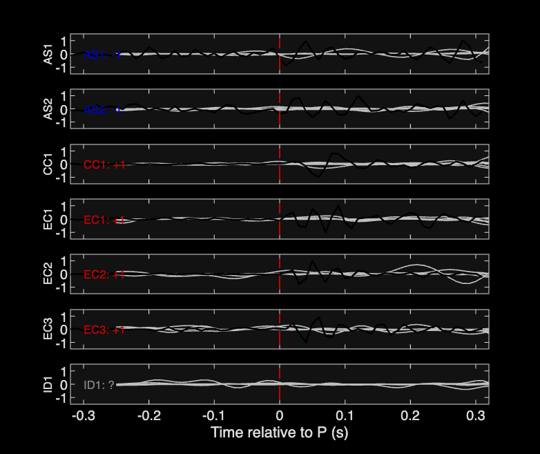 Waveforms
