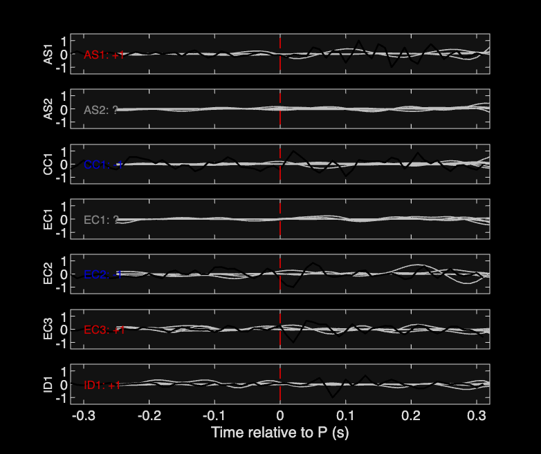 Waveforms