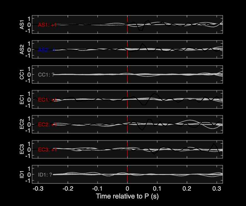 Waveforms