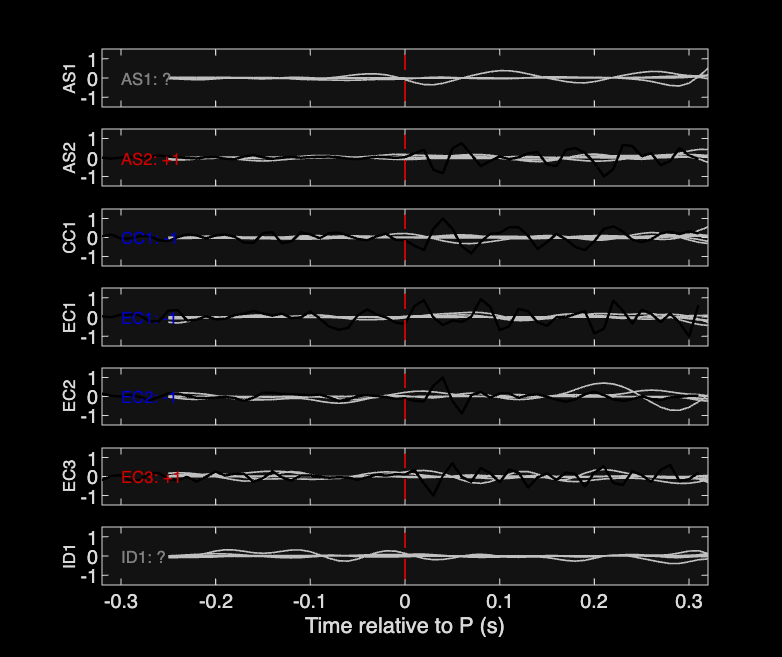 Waveforms