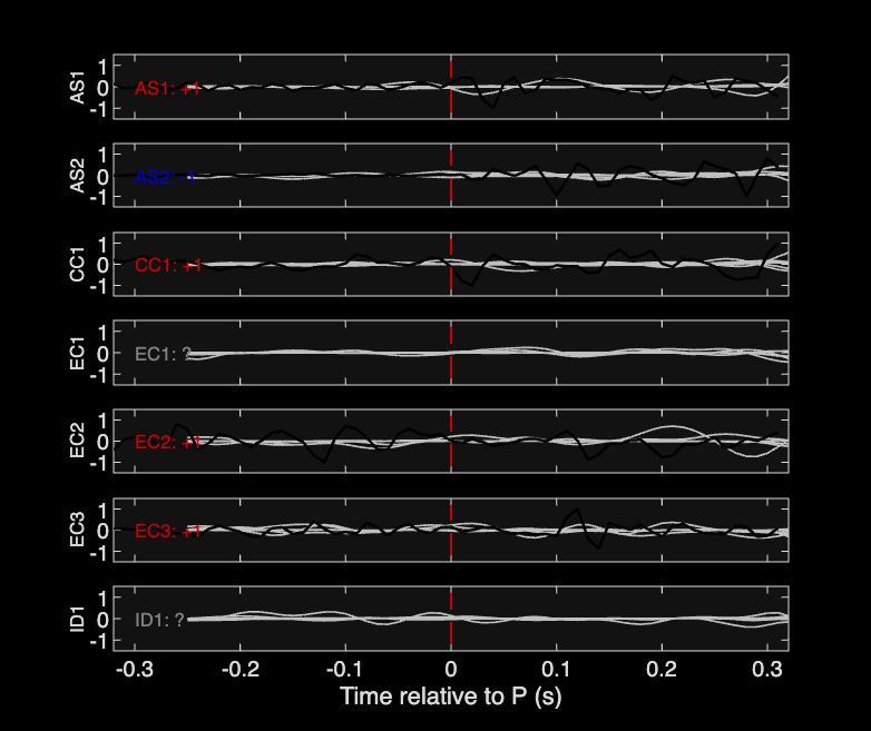 Waveforms
