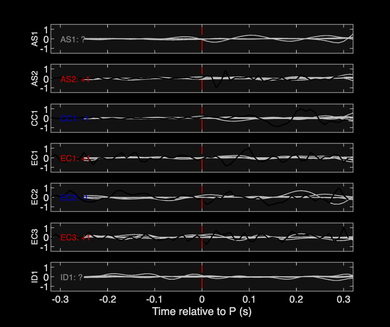 Waveforms