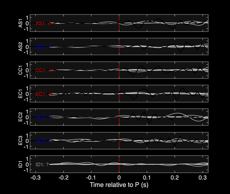 Waveforms