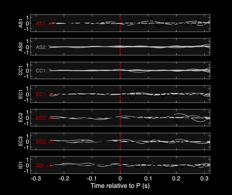 Waveforms