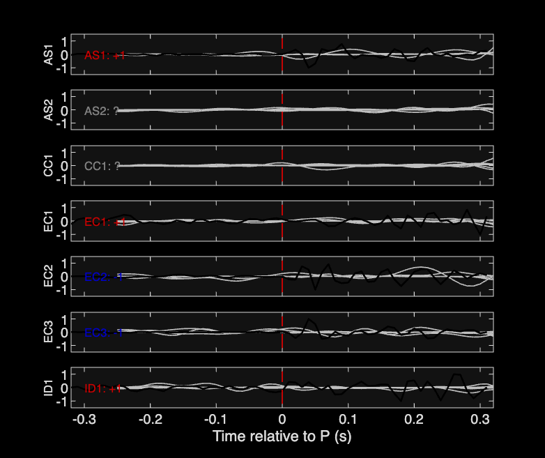 Waveforms