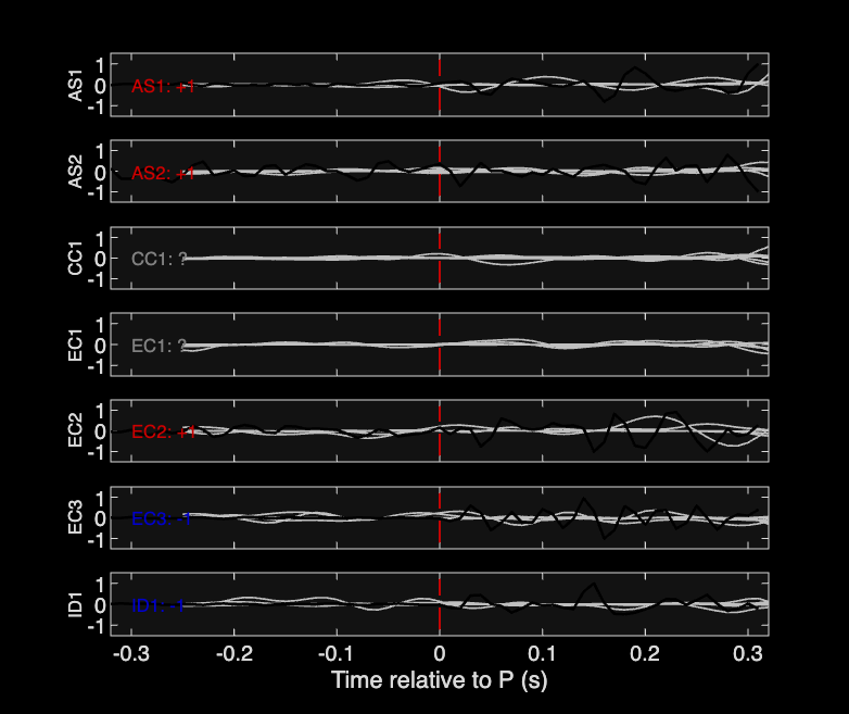Waveforms