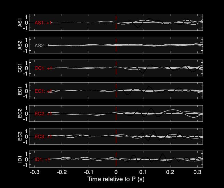 Waveforms