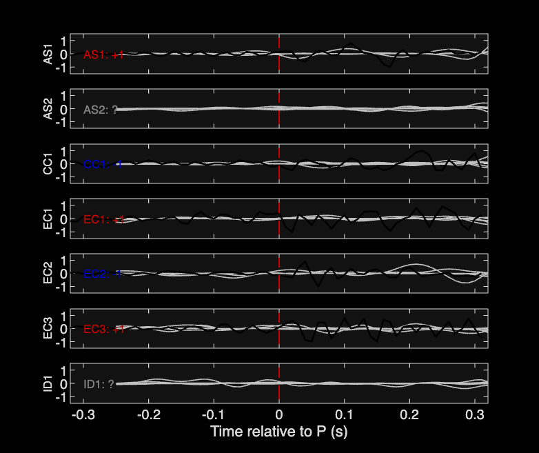 Waveforms