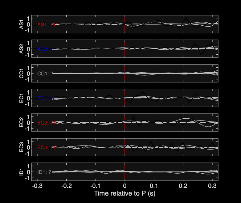 Waveforms