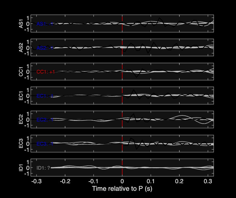 Waveforms