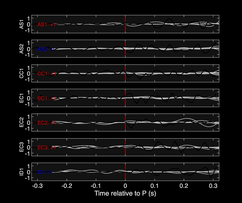 Waveforms