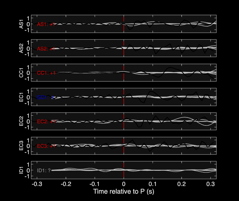 Waveforms