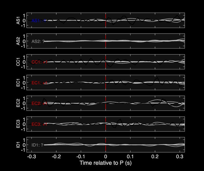 Waveforms