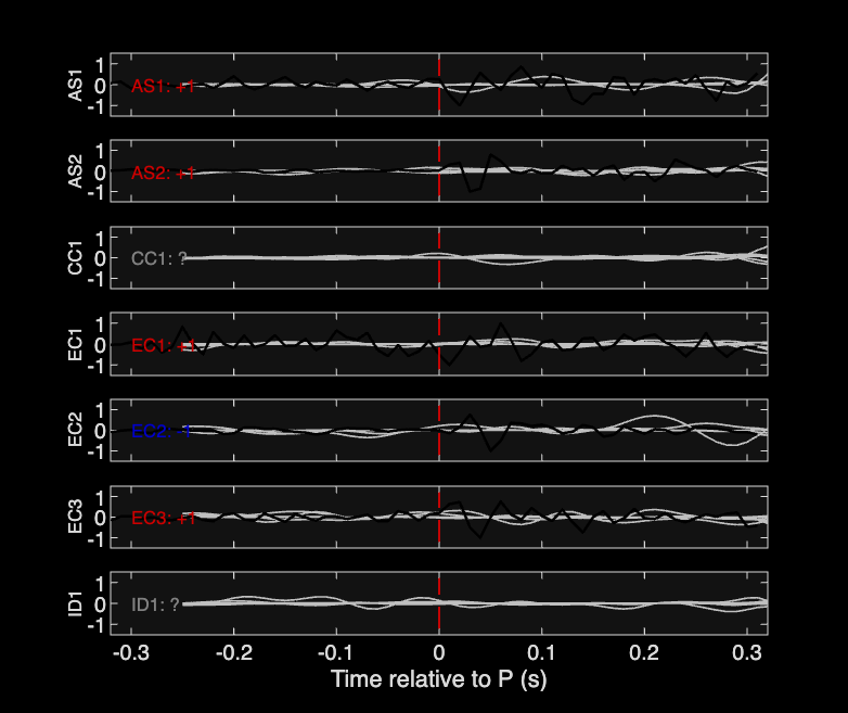 Waveforms