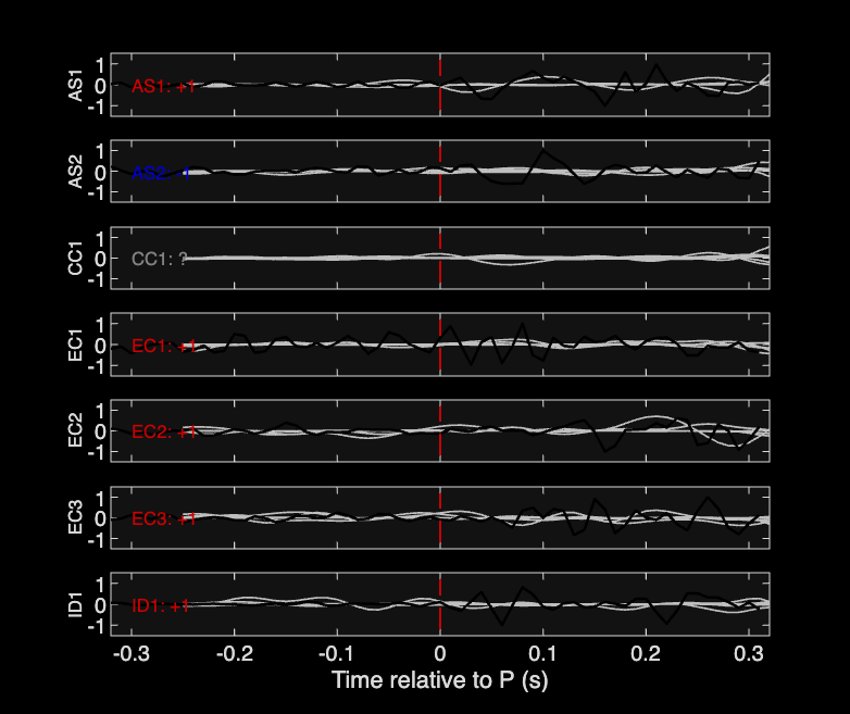Waveforms
