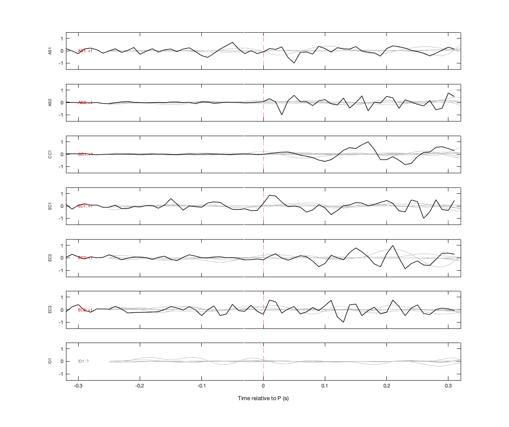 Waveforms