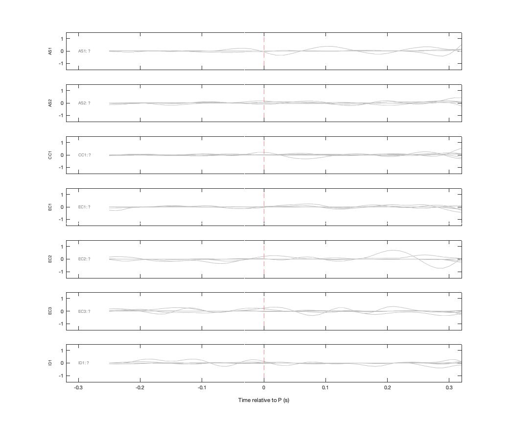 Waveforms
