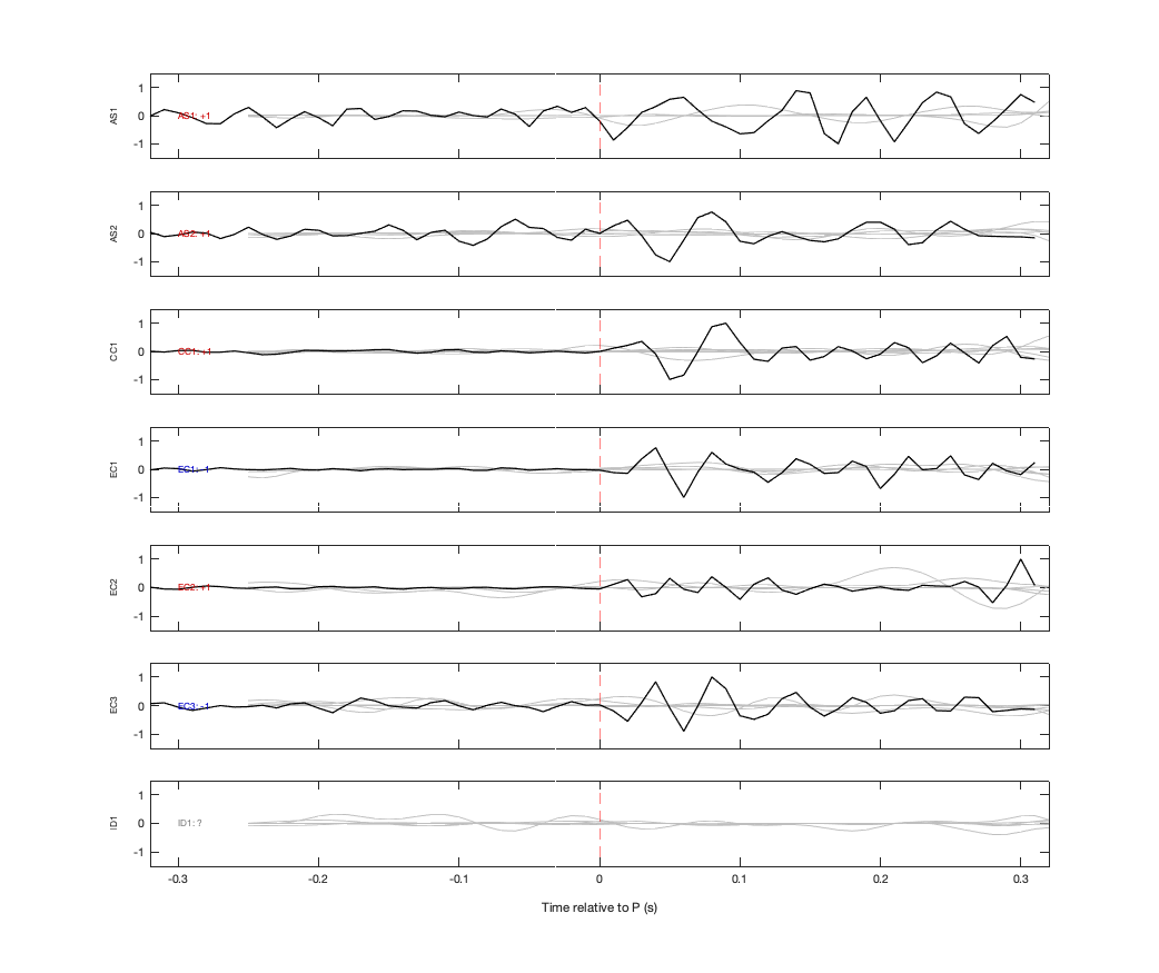 Waveforms