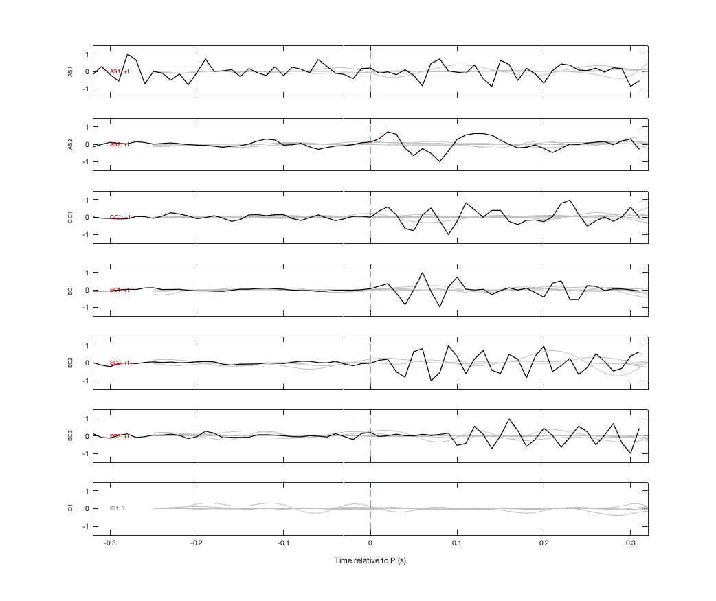 Waveforms