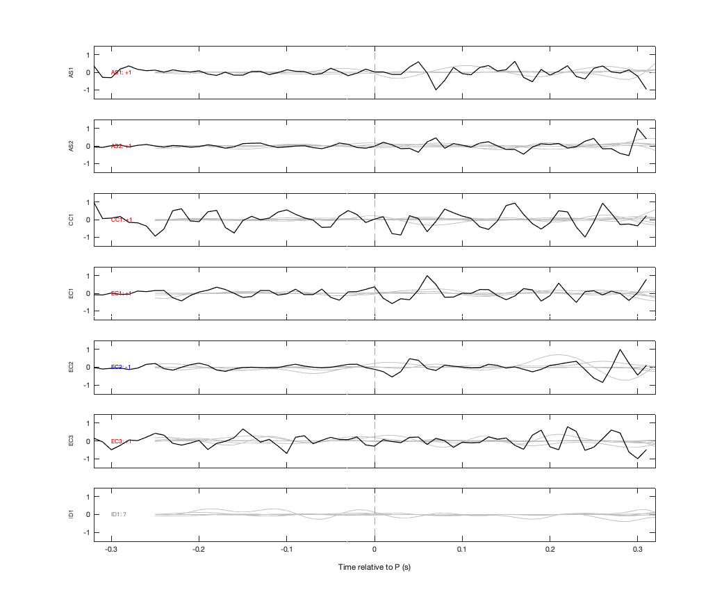 Waveforms
